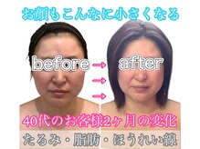 アールズ スリム(R's slim)/小顔に自信あり！フェイシャル