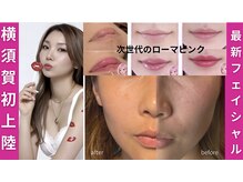 ビューティーツリー(Beauty Tree)