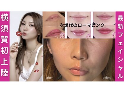 ビューティーツリー(Beauty Tree)の写真