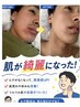 【学割U24】メンズヒゲ脱毛　2回