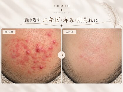 ルミウ(LUMIU)の写真