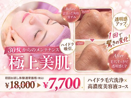 エム(M)の写真