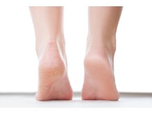 人気のフットケア！足裏の角質除去が付いたフットメニュー有。