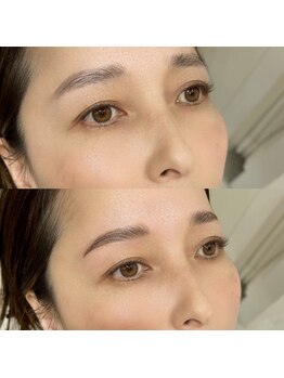 エリマ 茅ヶ崎(elima)/ハリウッドブロウリフト