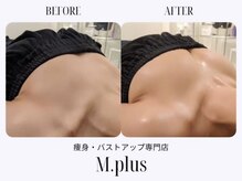 エムプリュ 心斎橋店(M.plus)/バストアップコース1回