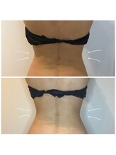 メディカルサロン MARUYAMA/[インディバ]　ボディ