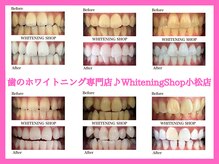 ホワイトニングショップ 小松店