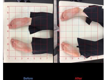 ストレチックス 近江八幡店/BeforeAfter