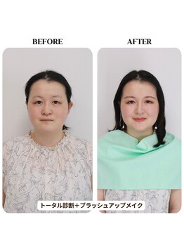 シュアリー(Surely)/トータルコースお客様