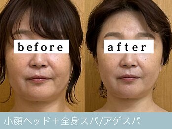 オーエン 小倉店(o-eN)/小顔ヘッド+全身スパ