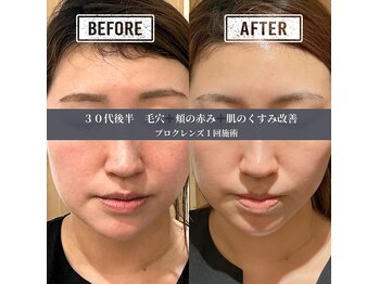 サトミスキンケアスタジオ(satomi skincare studio)