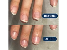 マニネイルケア 熊本店(maninail CARE)/ネイルケア