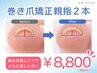 【巻き爪矯正】UPジェルで補正★爪のカット＋巻き爪ケア2本で￥8,800　