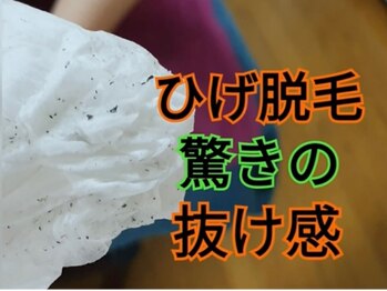 肌屋(HADA-YA)/毛が抜ける!メンズひげ脱毛★