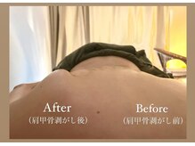 マルレ 三軒茶屋(MARLE)/特徴5 肩甲骨はがし◯姿勢改善