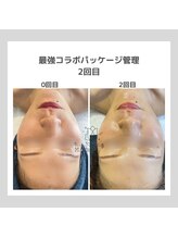 ポムハヌル(pom.haneul)/韓国肌管理室