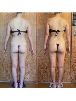 チェイル(JEIL)/痩身コルギ