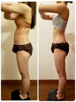 シエスタ(SIESTA)/Before→After 全身ほっそり！