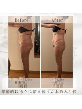 フローラ 自由が丘(Flora)/引締め［自由が丘］