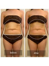 ウィズ ユー ビューティ(with U beauty)/全体的にお肉感減ってます