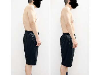 ミロク(369)/1回で猫背、巻き肩改善