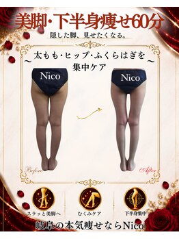 ニコ 岐南本店(Nico)の写真/本気痩せ専門店|太もも・ヒップ・ふくらはぎを集中ケア