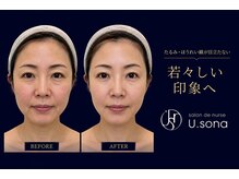 サロン ド ナース ユーソナ 松本店(salon de nurse U.sona)