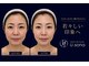 サロン ド ナース ユーソナ 松本店(salon de nurse U.sona)の写真/たるみ・ほうれい線を土台からケア。理想のフェイスラインへ導く小顔施術。