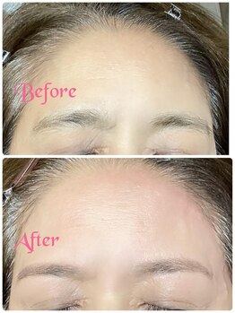 ビューステージ アイブロウサロン 吉祥寺/額ワックスもあります
