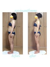 ラヴィソンファム(Ravissant femme)/痩身エステ/ビフォー＆アフター