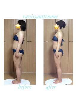 ラヴィソンファム(Ravissant femme)/痩身エステ/ビフォー＆アフター