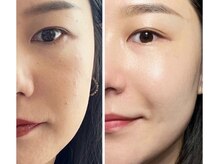 モッド(MOD)/ヴァルモン