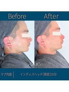 スー(Sue)/ヘッド20分before→after