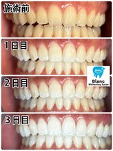 ブラン 心斎橋店(Blanc)/年間メンテナンス付プラン実例1