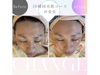 美顔アンドリラクゼーションルーム ソワン沙季の写真