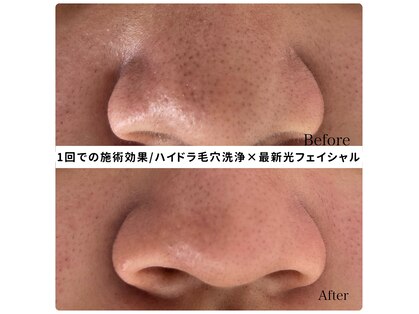 ベルエクラ(Bel Eclat)の写真