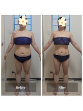 ヨサパーク マグリング(YOSA PARK Magring)/ビフォー&アフター