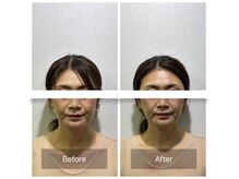 シャルム(CHARMEB)の雰囲気（効果を実感できる美容鍼サロン★小顔/美容鍼/天王寺）