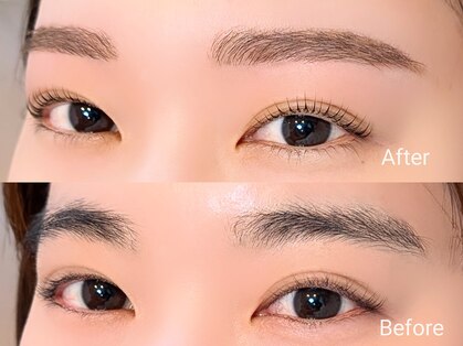 フォルミー(forume)の写真