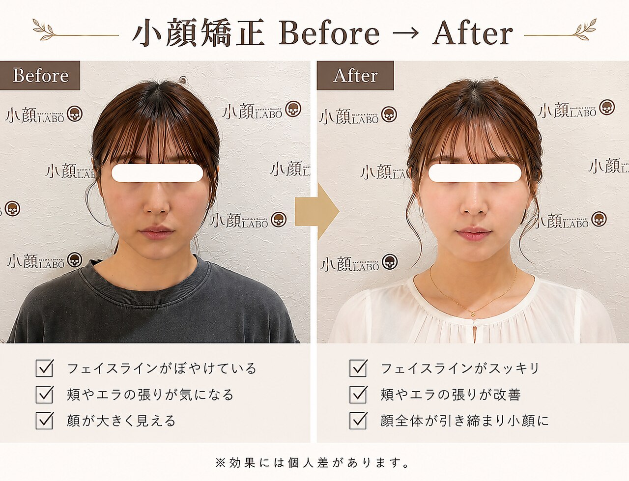 小顔ラボ 心斎橋店(小顔LABO)｜ホットペッパービューティー