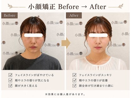 小顔ラボ 心斎橋店(小顔LABO)の写真