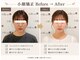 小顔ラボ 心斎橋店(小顔LABO)の写真