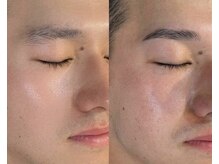 ハリウッドブロウリフト ワクシー 表参道店(HOLLYWOOD BROW LIFT WAXYYY.)/メンズ新HBL