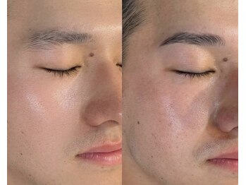 ハリウッドブロウリフト ワクシー 表参道店(HOLLYWOOD BROW LIFT WAXYYY.)/メンズ新HBL