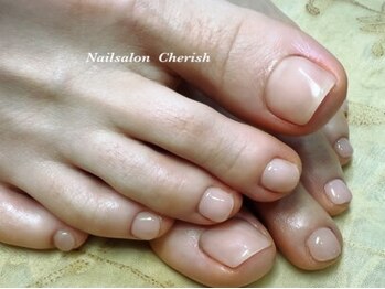ネイルサロン チェリッシュ(Nailsalon Cherish)の写真/【フット巻き爪・トラブル爪にお悩みの方】韓国発特許取得済みの特殊ジェルを使用した革新的な巻き爪ケア
