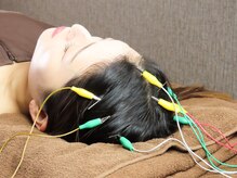 康泰苑鍼灸整体院/大塚/鍼灸/整体/カッピング