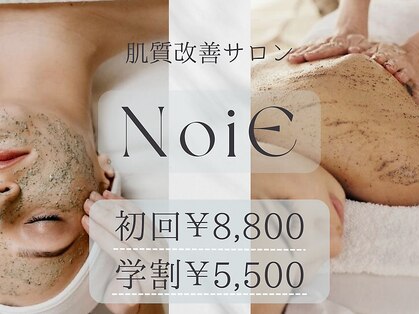 ノイエ(NOIE)の写真