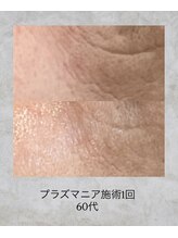 コンクパール(CONCH PEARL.)/プラズマニア