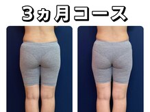 久留米スポーツ整骨院 整体院/エステ◆痩身インディバエステ