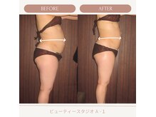 ビューティースタジオ エイワン(A1)の雰囲気（Before/After★全身ボディ／痩身＋リンパマッサージ）